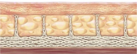Ultherapy 3 Ultherapy 3