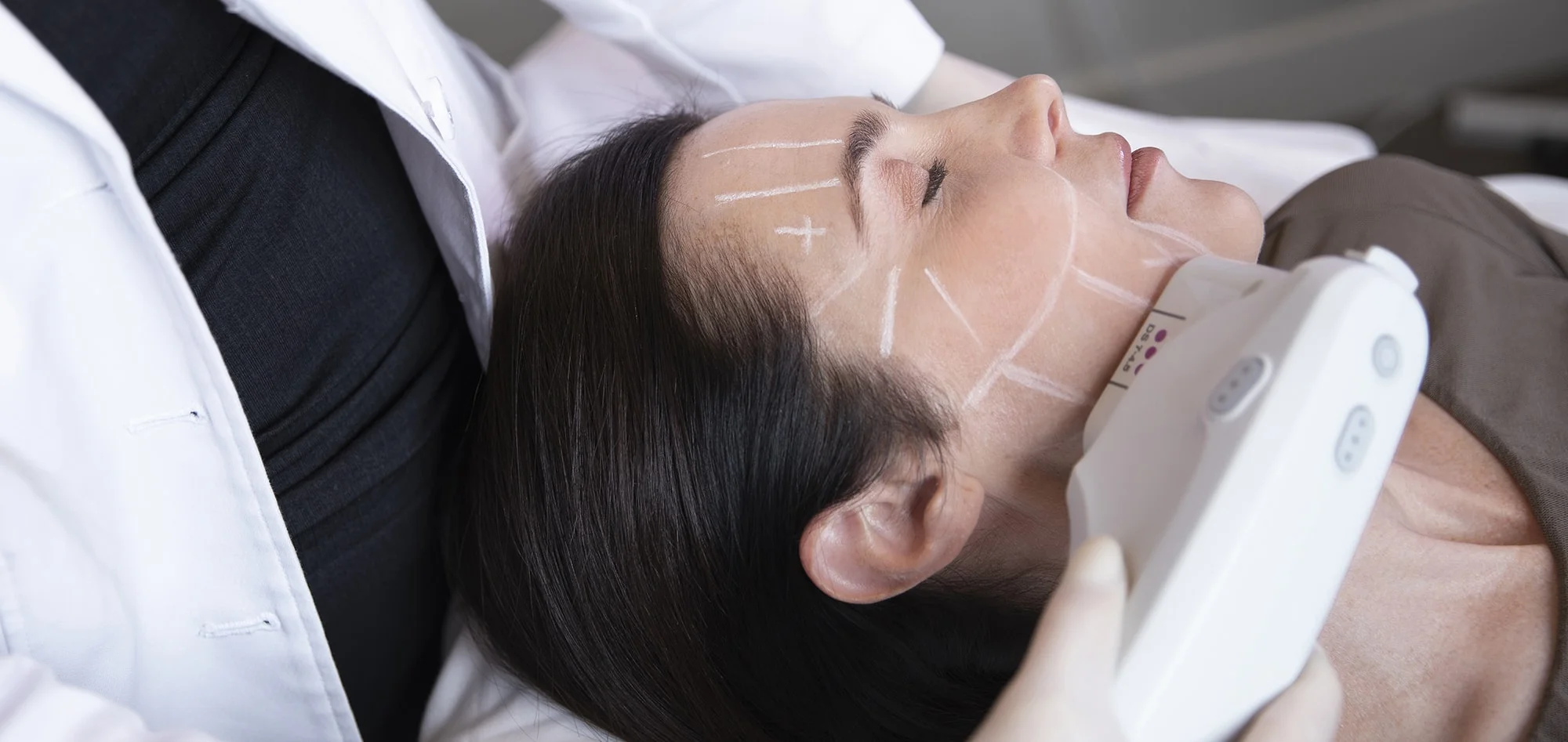 ultherapy device ultherapy device